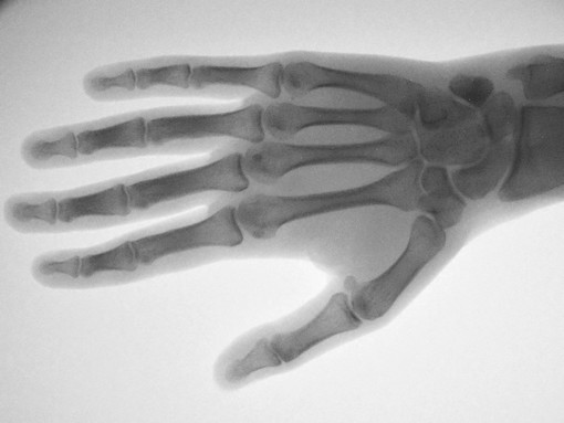 Fluoroskopický röntgen 2 – Svetlana